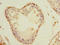 Phospholipase A And Acyltransferase 3 antibody, A60290-100, Epigentek, Immunohistochemistry paraffin image 