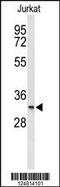 Transmembrane Protein 150A antibody, 63-911, ProSci, Western Blot image 