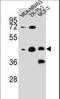 Kelch Repeat And BTB Domain Containing 13 antibody, LS-B11098, Lifespan Biosciences, Western Blot image 