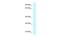 Charged Multivesicular Body Protein 4A antibody, A07217, Boster Biological Technology, Western Blot image 