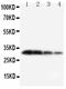 Kallikrein 1 antibody, GTX12058, GeneTex, Western Blot image 