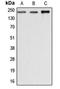 Dysferlin antibody, LS-C353040, Lifespan Biosciences, Western Blot image 