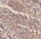 Sterile Alpha Motif Domain Containing 4A antibody, FNab07588, FineTest, Immunohistochemistry paraffin image 