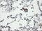 VHL Binding Protein 1 antibody, M08073, Boster Biological Technology, Immunohistochemistry paraffin image 