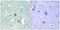 Inositol 1,4,5-Trisphosphate Receptor Type 1 antibody, LS-C199127, Lifespan Biosciences, Immunohistochemistry paraffin image 