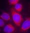 CPI17 antibody, orb14663, Biorbyt, Immunofluorescence image 