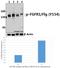 Fibroblast Growth Factor Receptor 1 antibody, A00098Y154, Boster Biological Technology, Western Blot image 