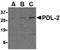 Programmed Cell Death 1 Ligand 2 antibody, LS-C19687, Lifespan Biosciences, Western Blot image 