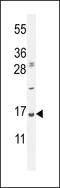 Ubiquitin A-52 Residue Ribosomal Protein Fusion Product 1 antibody, MBS9205540, MyBioSource, Western Blot image 