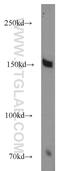 Transcriptional Repressor GATA Binding 1 antibody, 21938-1-AP, Proteintech Group, Western Blot image 