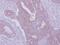 Hepatocyte Growth Factor-Regulated Tyrosine Kinase Substrate antibody, PA5-27491, Invitrogen Antibodies, Immunohistochemistry paraffin image 