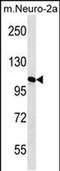 Mannosidase Alpha Class 2A Member 2 antibody, PA5-48385, Invitrogen Antibodies, Western Blot image 