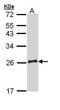 Growth Hormone 2 antibody, PA5-34767, Invitrogen Antibodies, Western Blot image 