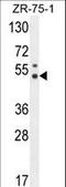 Pseudouridine Synthase 3 antibody, LS-C162328, Lifespan Biosciences, Western Blot image 