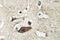 Tumor Susceptibility 101 antibody, LS-C176945, Lifespan Biosciences, Immunohistochemistry paraffin image 