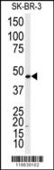 Adrenoceptor Beta 2 antibody, 62-775, ProSci, Western Blot image 