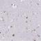 Membrane Spanning 4-Domains A12 antibody, NBP2-30744, Novus Biologicals, Immunohistochemistry frozen image 