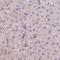 Transmembrane Protein 237 antibody, HPA054732, Atlas Antibodies, Immunohistochemistry paraffin image 