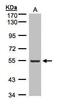 Integrin Linked Kinase antibody, PA5-27484, Invitrogen Antibodies, Western Blot image 