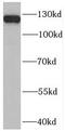 Pleckstrin Homology, MyTH4 And FERM Domain Containing H2 antibody, FNab06542, FineTest, Western Blot image 