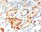 Anillin Actin Binding Protein antibody, ab5910, Abcam, Immunohistochemistry paraffin image 