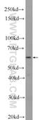 Transmembrane Protein 102 antibody, 25505-1-AP, Proteintech Group, Western Blot image 