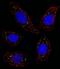 MER Proto-Oncogene, Tyrosine Kinase antibody, PA5-15028, Invitrogen Antibodies, Immunofluorescence image 
