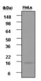 ISG15 Ubiquitin Like Modifier antibody, GTX50062, GeneTex, Western Blot image 