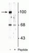 Glutamate Ionotropic Receptor AMPA Type Subunit 2 antibody, P02905, Boster Biological Technology, Western Blot image 