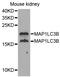 Microtubule Associated Protein 1 Light Chain 3 Beta antibody, abx005432, Abbexa, Western Blot image 