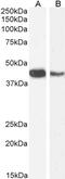 Actin Alpha 2, Smooth Muscle antibody, PA5-18292, Invitrogen Antibodies, Western Blot image 