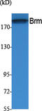 SWI/SNF Related, Matrix Associated, Actin Dependent Regulator Of Chromatin, Subfamily A, Member 2 antibody, STJ96404, St John