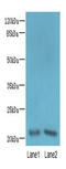 Coiled-Coil Domain Containing 32 antibody, A67790-100, Epigentek, Western Blot image 