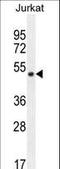 Smad Nuclear Interacting Protein 1 antibody, LS-C161345, Lifespan Biosciences, Western Blot image 