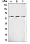 Checkpoint Kinase 1 antibody, LS-C352010, Lifespan Biosciences, Western Blot image 