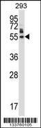 Protein HEXIM1 antibody, MBS9207404, MyBioSource, Western Blot image 