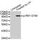 RB Transcriptional Corepressor 1 antibody, MBS128502, MyBioSource, Western Blot image 