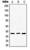 Glycogen Synthase Kinase 3 Beta antibody, LS-C352304, Lifespan Biosciences, Western Blot image 