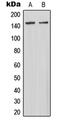 Microtubule Associated Serine/Threonine Kinase 3 antibody, MBS821974, MyBioSource, Western Blot image 