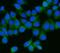 AP2M1 antibody, A06179-3, Boster Biological Technology, Immunofluorescence image 