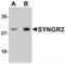 Synaptogyrin 2 antibody, NBP1-77101, Novus Biologicals, Western Blot image 