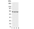 Cystathionine-Beta-Synthase antibody, R30619, NSJ Bioreagents, Western Blot image 
