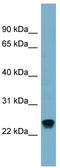 RAB22A, Member RAS Oncogene Family antibody, TA344771, Origene, Western Blot image 