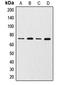 Matrix Metallopeptidase 2 antibody, LS-C352523, Lifespan Biosciences, Western Blot image 