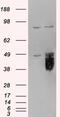 Tissue Factor Pathway Inhibitor antibody, 45-160, ProSci, Western Blot image 