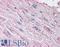 Endothelin Receptor Type A antibody, LS-A4067, Lifespan Biosciences, Immunohistochemistry paraffin image 