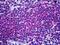 IL2 Inducible T Cell Kinase antibody, orb94418, Biorbyt, Immunohistochemistry paraffin image 