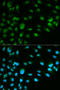 Minichromosome Maintenance Complex Component 7 antibody, STJ24528, St John