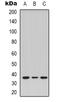 Taste 2 Receptor Member 14 antibody, orb339177, Biorbyt, Western Blot image 