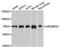 Kringle Containing Transmembrane Protein 1 antibody, STJ112530, St John